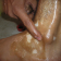Anti Vitiligo Oil Treatment