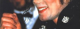 Michael Jackson Have Vitiligo
